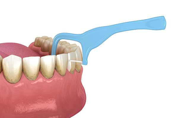 When Brushing And Flossing Causes Bleeding Gums
