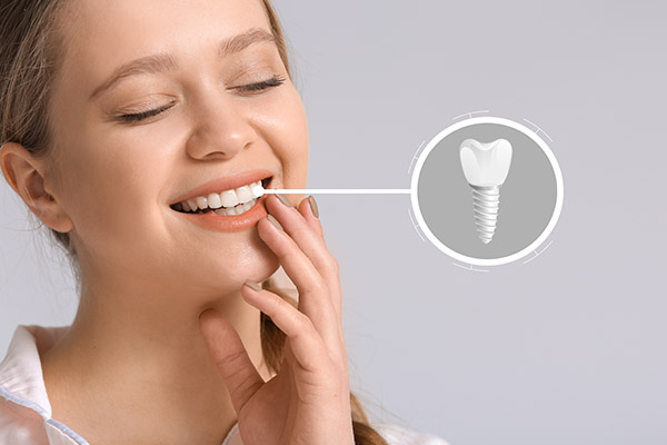 Gum Disease and Dental Implants